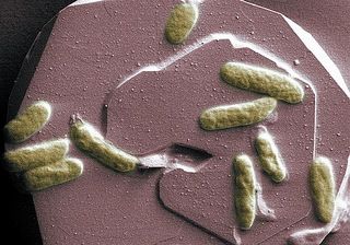 Shewanella oneidensis, which "breathes" iron, is an example of a microbe that uses extracellular electron transfer.