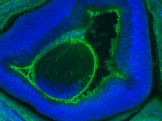 Human cells (green) that developed in a mouse embryo's eye (blue).