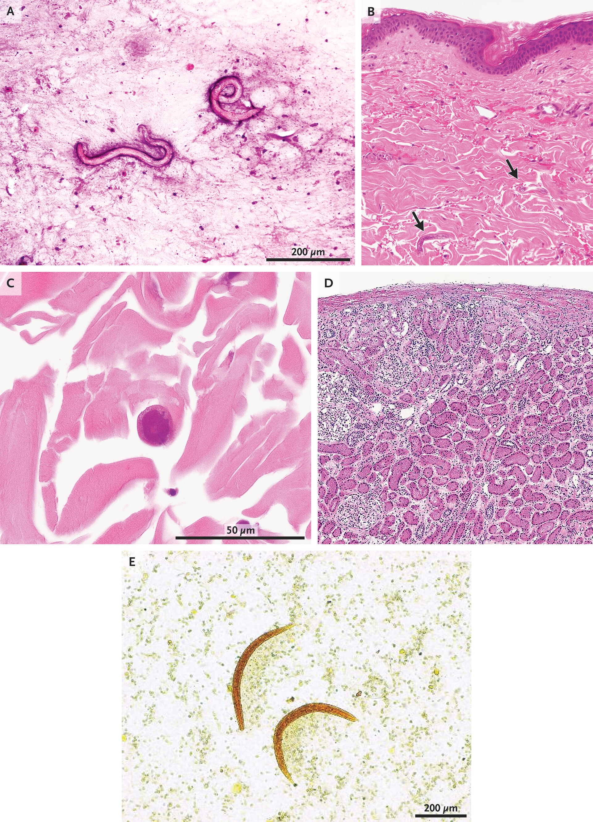 a series of microscope images showing parasites embedded in tissue