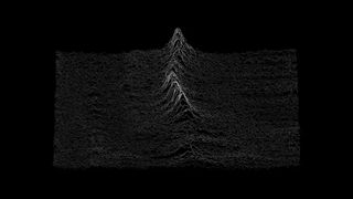 Visualization of brain waves is black and white and looks similar to a thin mountain range as depicted on a topographical map