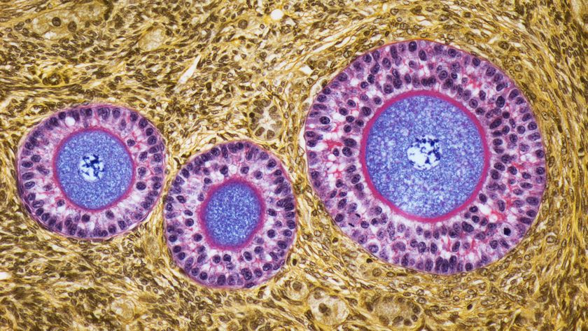 image of three human egg cells inside ovarian follicles