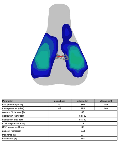 A visual output of saddle pressure mapping