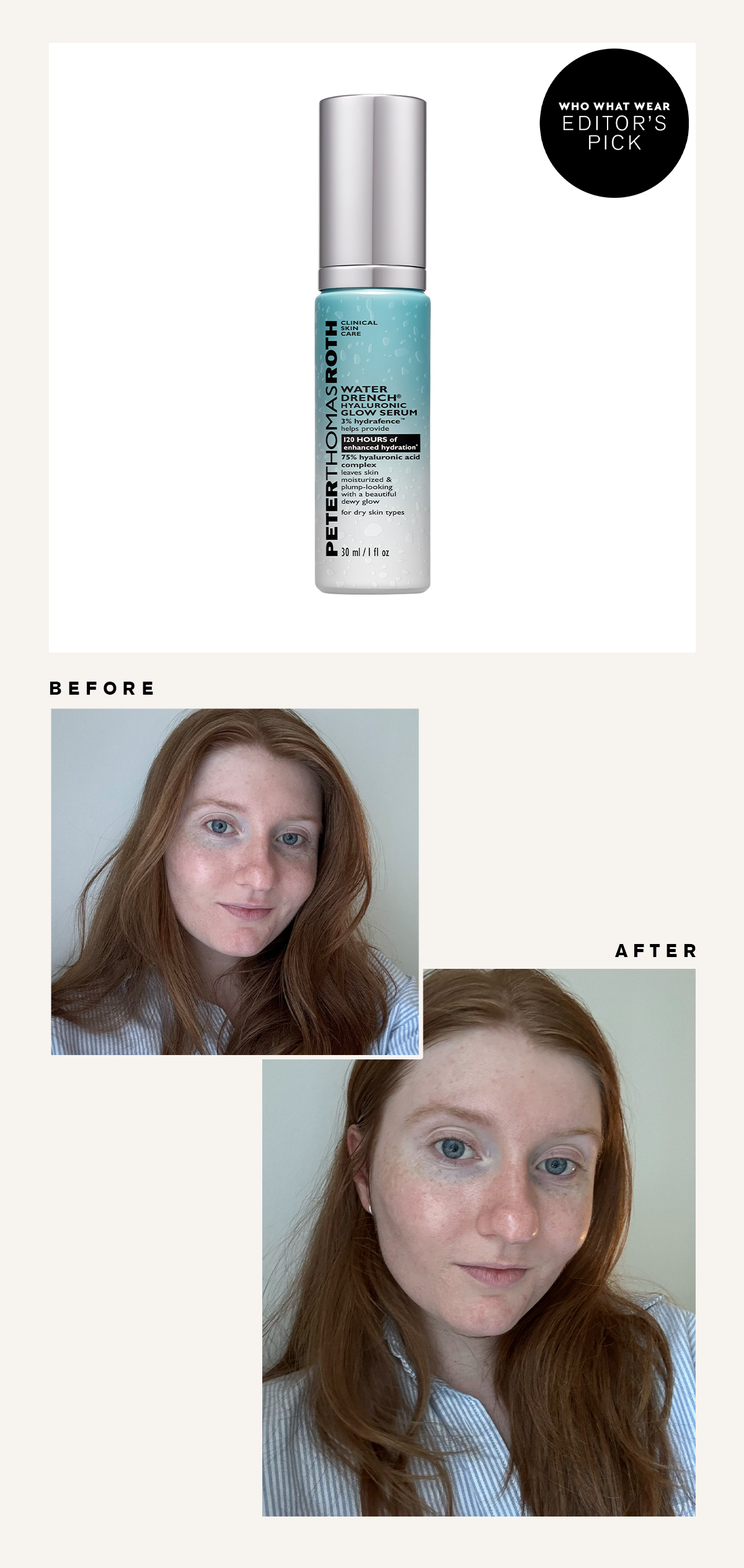 Peter Thomas Roth Hyaluronic Acid Serum: Before and After Picture