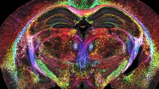 A colorful MRI scan of a mouse's brain. 