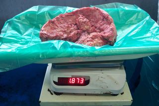 The tumor is weighed on a scale after it was removed.
