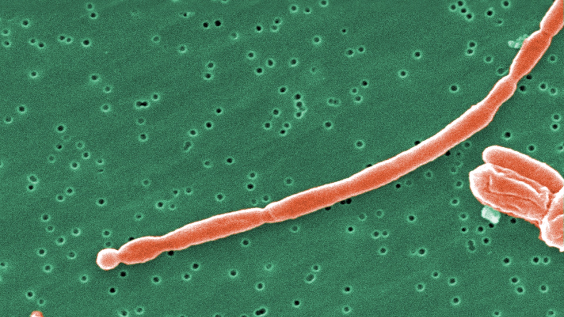 A rod-shaped E coli bacterial cell shown in orange against a green background