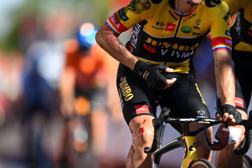 TOMARES SPAIN SEPTEMBER 06 Detail view of Primoz Roglic of Slovenia crossing the finish line injured after being involved in a crash in the final sprint during the 77th Tour of Spain 2022 Stage 16 a 1894km stage from Sanlcar de Barrameda to Tomares LaVuelta22 WorldTour on September 06 2022 in Tomares Spain Photo by Justin SetterfieldGetty Images