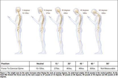Study: Staring at your phone while texting is like putting a 60-pound weight on your spine