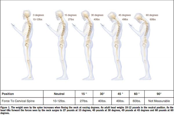 Study: Staring at your phone while texting is like putting a 60-pound weight on your spine