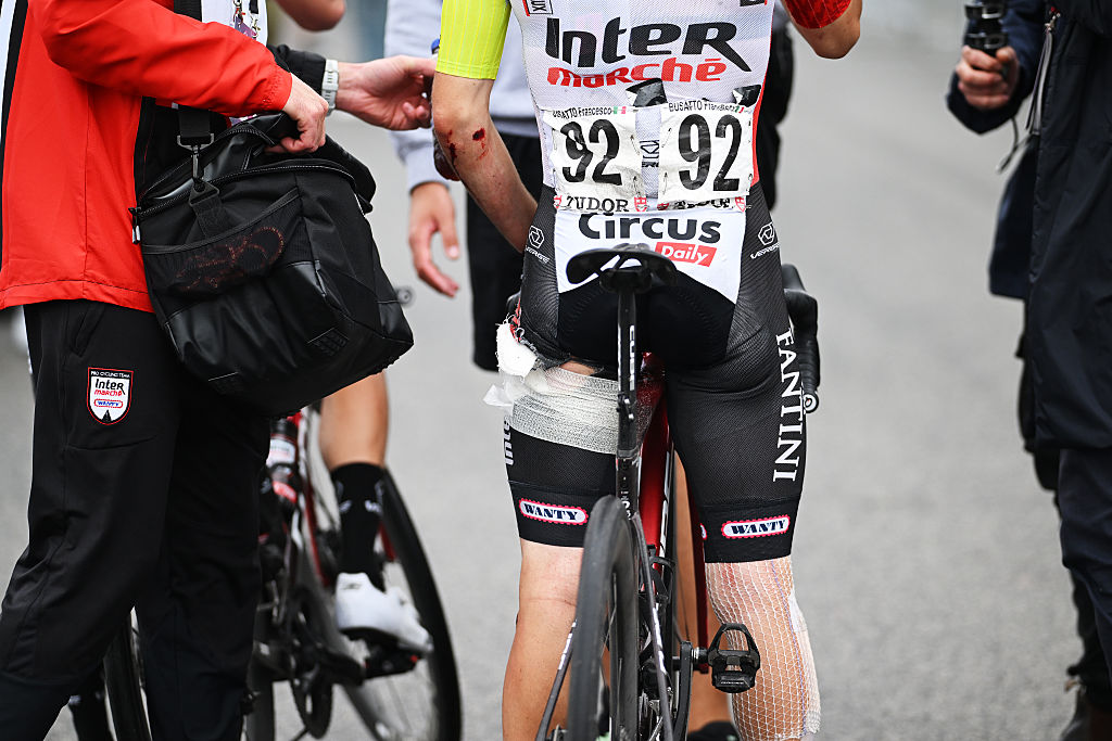 NAPOLI ITALY MAY 15 Detail view of Francesco Busatto of Italy and Team Intermarche Wanty involved in a crash after the 108th Giro dItalia 2025 Stage 6 a 227km stage from Potenza to Napoli UCIWT on May 15 2025 in Potenza Italy Photo by Dario BelingheriGetty Images