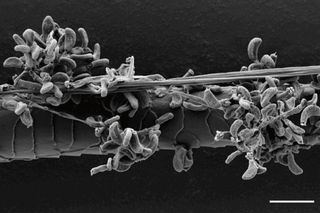 Scanning electron micrograph of a bat hair colonized by fungus.