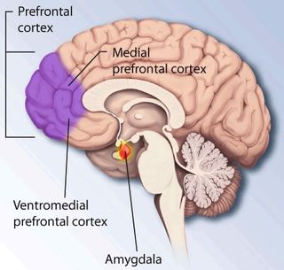 Un diagrama que muestra una sección transversal del cerebro con etiquetas para la corteza prefrontal, la corteza prefrontal medial, la corteza prefrontal ventromedial y la amígdala.