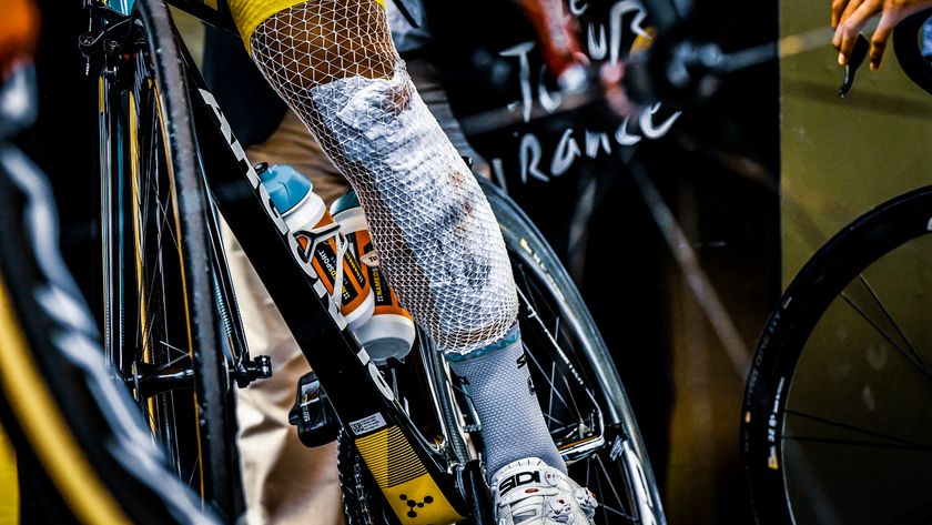 The bandaged leg of Kazakhstan&#039;s Alexey Lutsenko is pictured prior to the 178 km tenth stage of the 104th edition of the Tour de France cycling race on July 11, 2017 between Perigueux and Bergerac. (Photo by PHILIPPE LOPEZ / AFP)