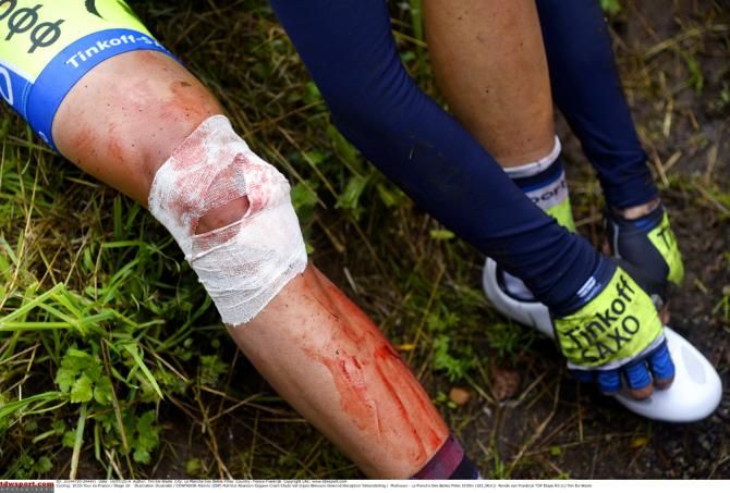It's all over for Alberto Contador at the Tour de France after his crash in stage 10