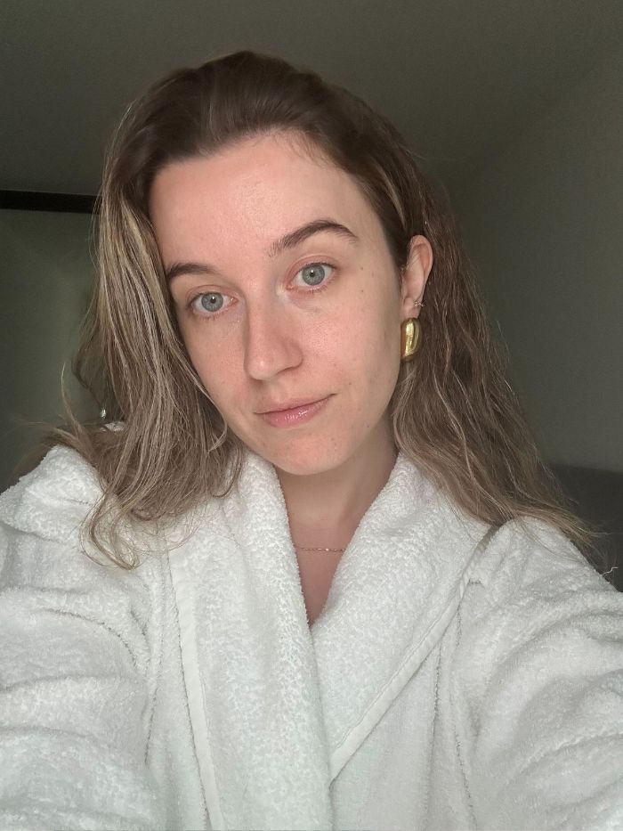 Junior beauty editor Grace Lindsay after using the A313 retinol