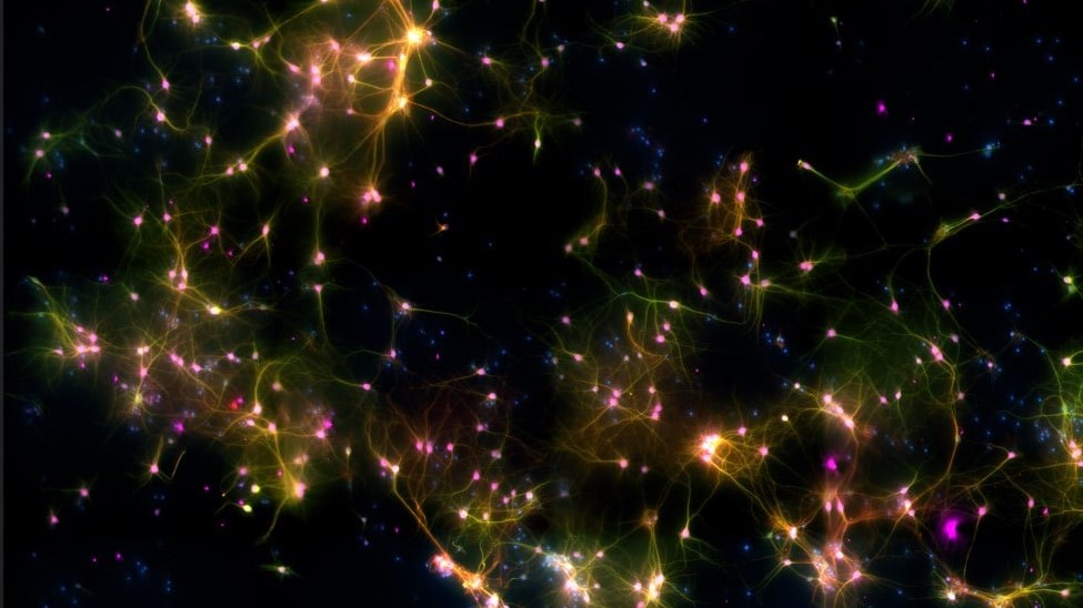 An edited microscopy image of the DishbBrain system showing the numerous connections between human and mouse brain cells.