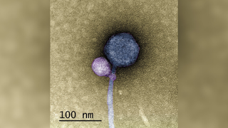 Transmission electron microscope image of a small satellite virus (in purple) that is attaching to the "neck" of a larger helper virus (in blue.) A bar labeled as 100 nanometers long has been placed alongside for scale