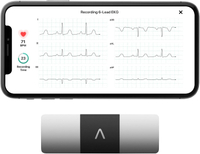 KardiaMobile EKG Monitor