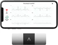 KardiaMobile EKG Monitor