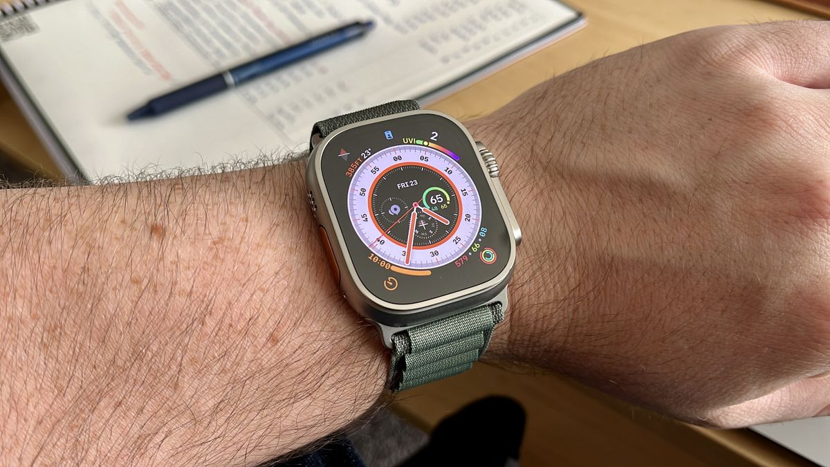 Read more about the article Your filthy Apple Watch band might kill you, examine finds
