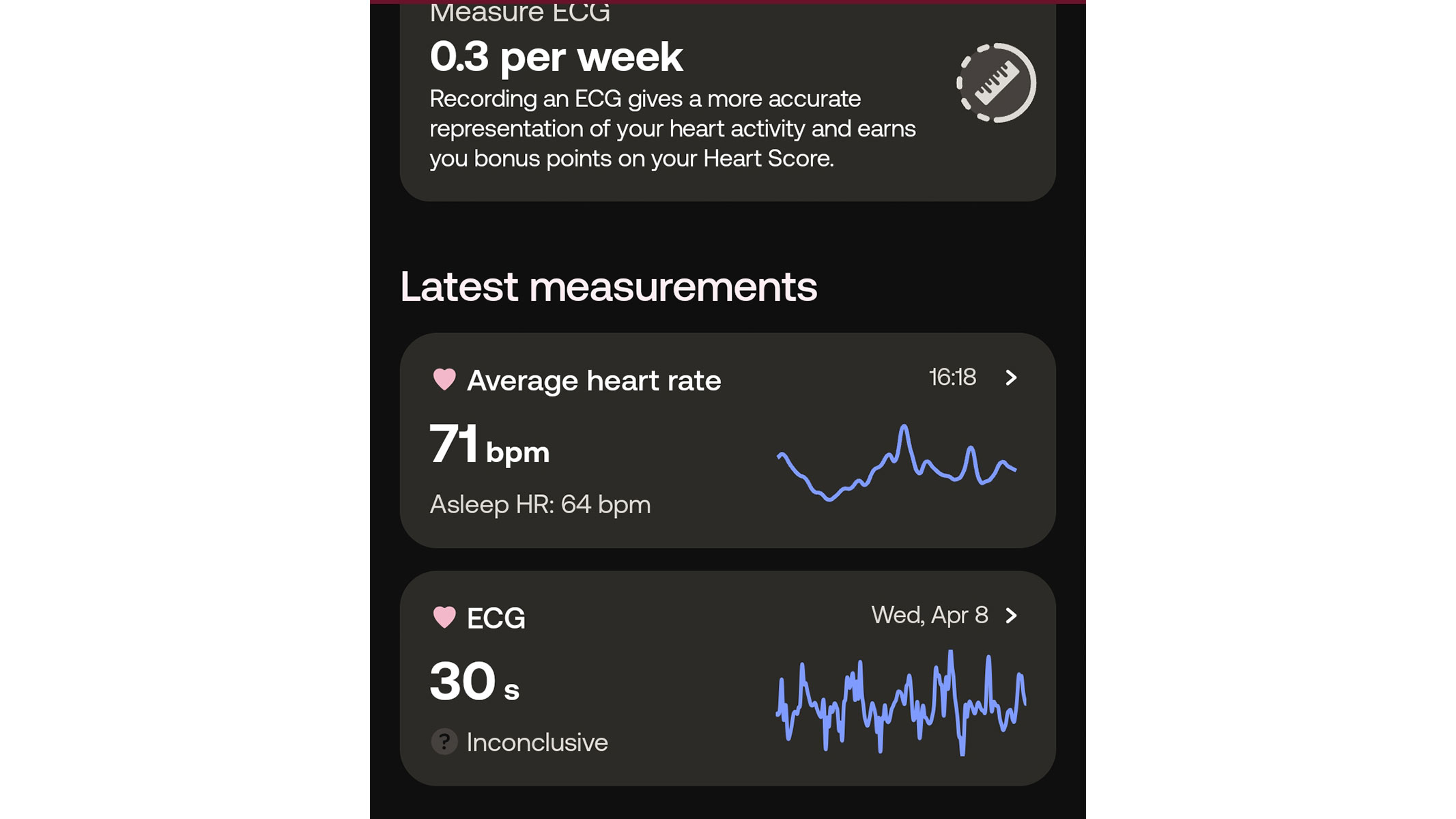 a screenshot of the ECG tracking feature from the Withings app