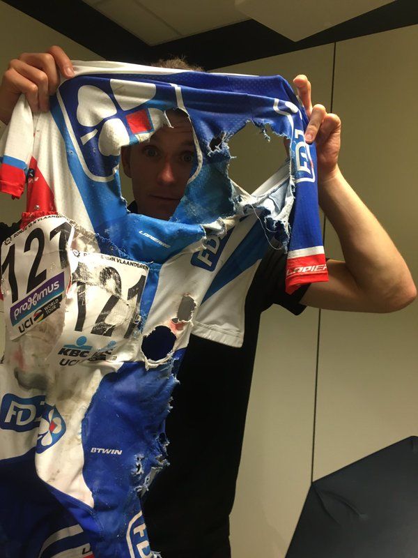 Arnud Demare shows his shredded FDJ jersey after his Tour of Flanders crash