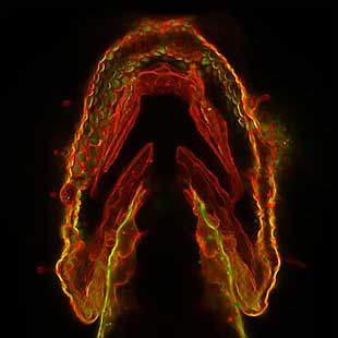 Copper-free click chemistry allowed researchers to illuminate glycans inside the jaw of this zebrafish embryo.
