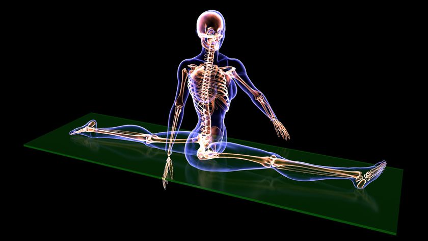 An MRI scan showing a person doing the splits. 