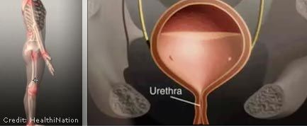 Can your Bladder Burst when you Hold your Pee?! A Urologist explains 