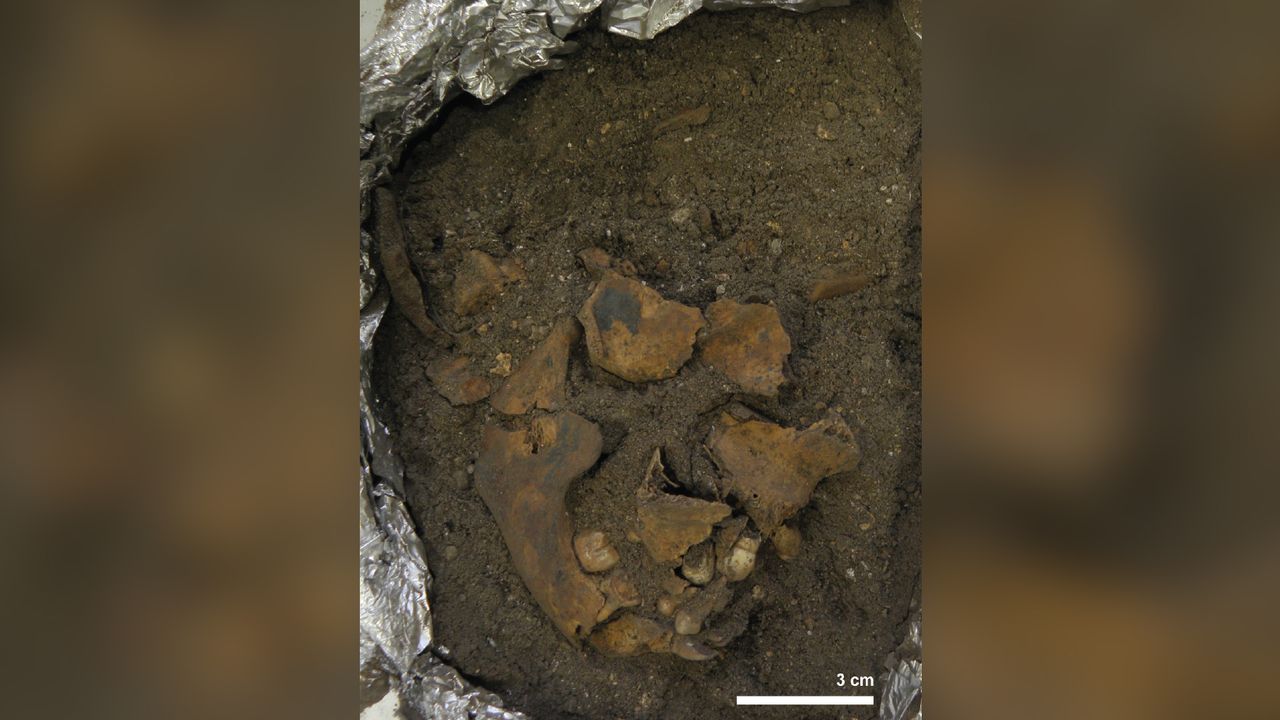 The child's fragmented jaw and skull