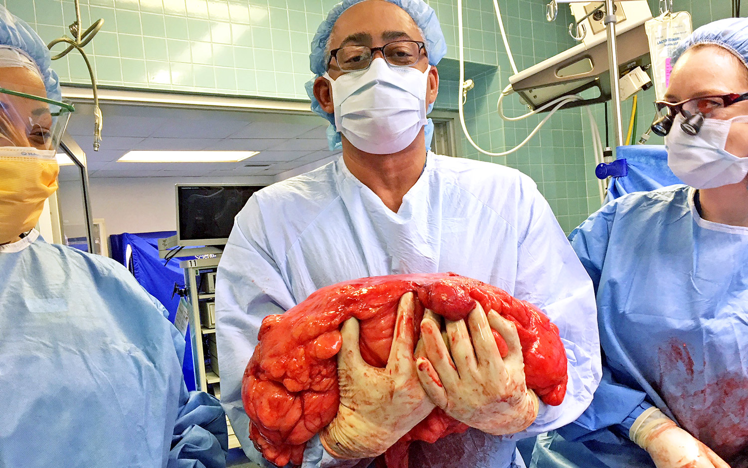 A Man's 'Beer Belly' Was Actually a Massive Tumor | Live Science