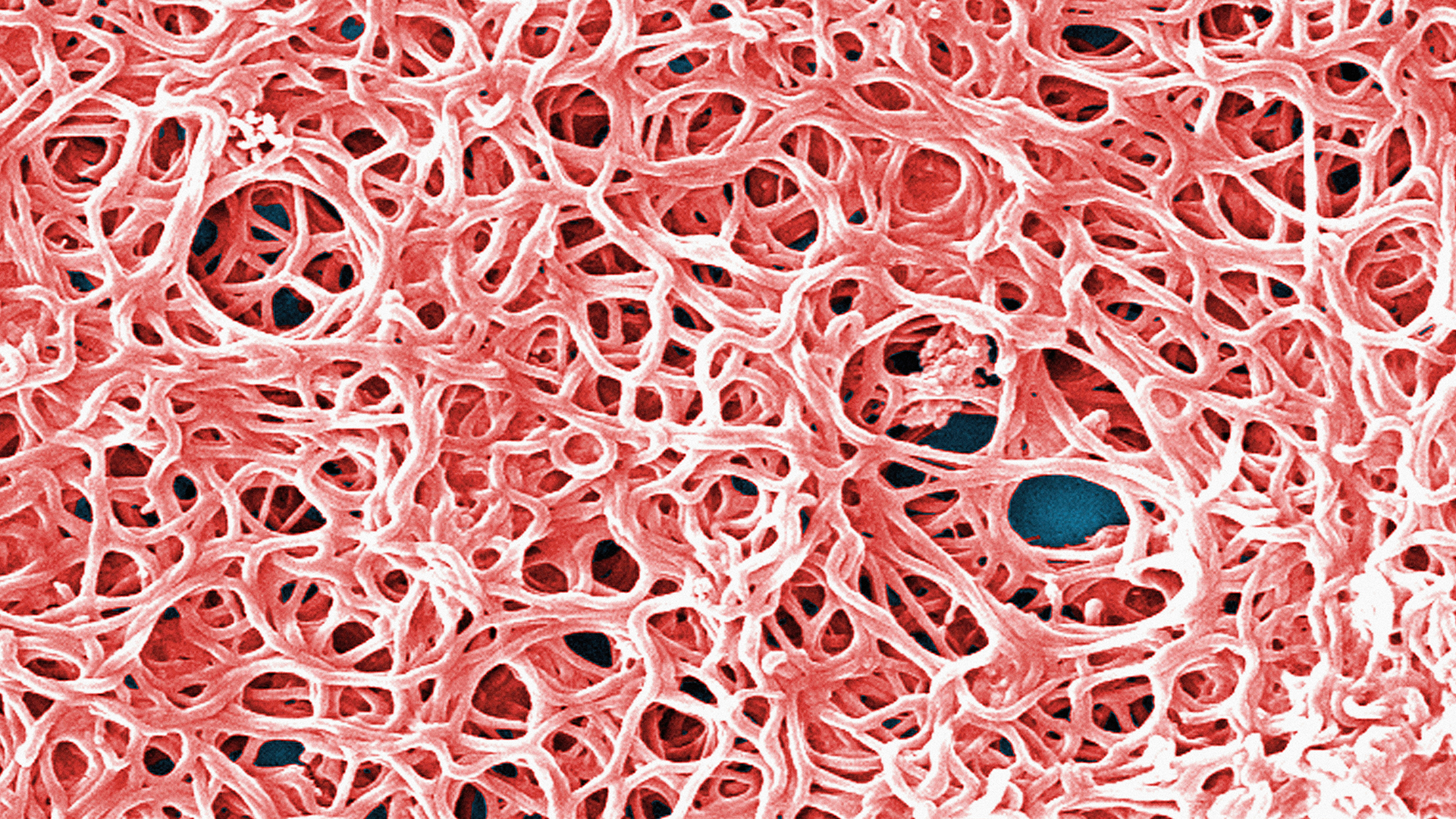 image of Borrelia burgdorferi bacteria growing tangled together like clumps of sticky string