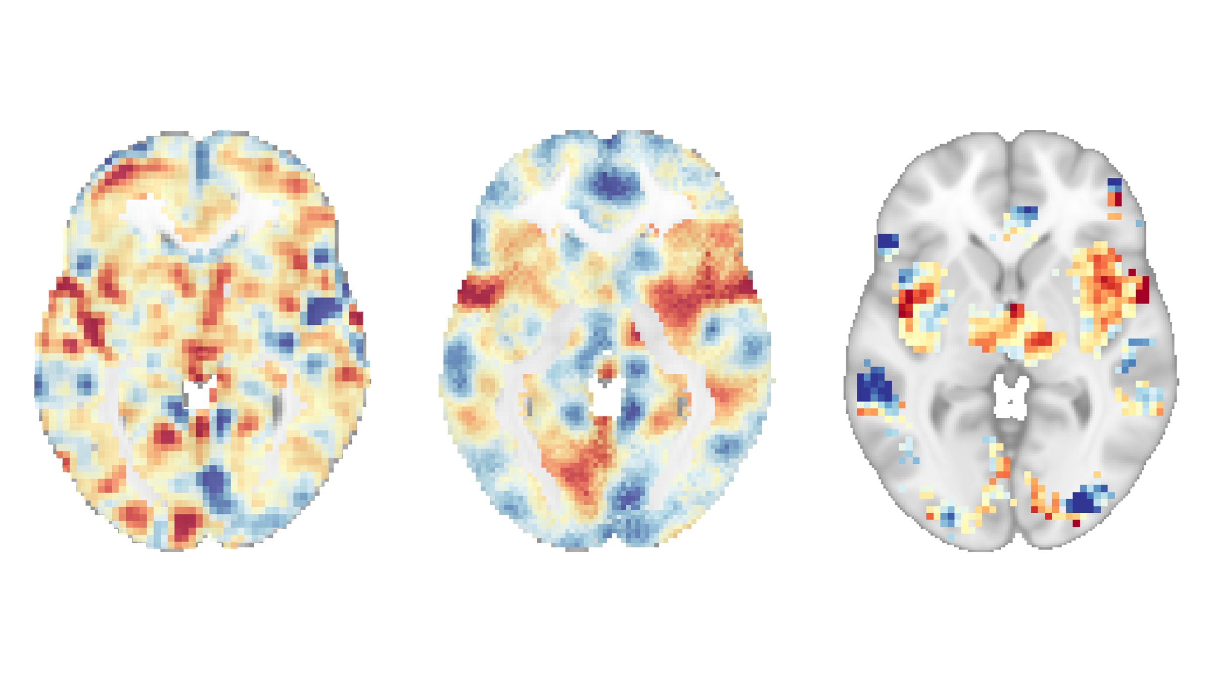 Mindfulness meditation in point of fact does relieve ache, mind scans divulge