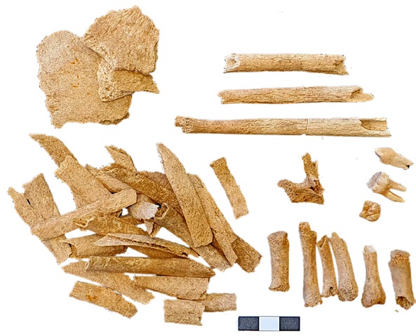 a collection of human bones
