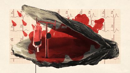 Photo collage of an oyster with a blood bag on an IV drip