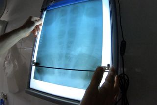 An X-ray of the sea turtle's innards, which showed the trash inside.