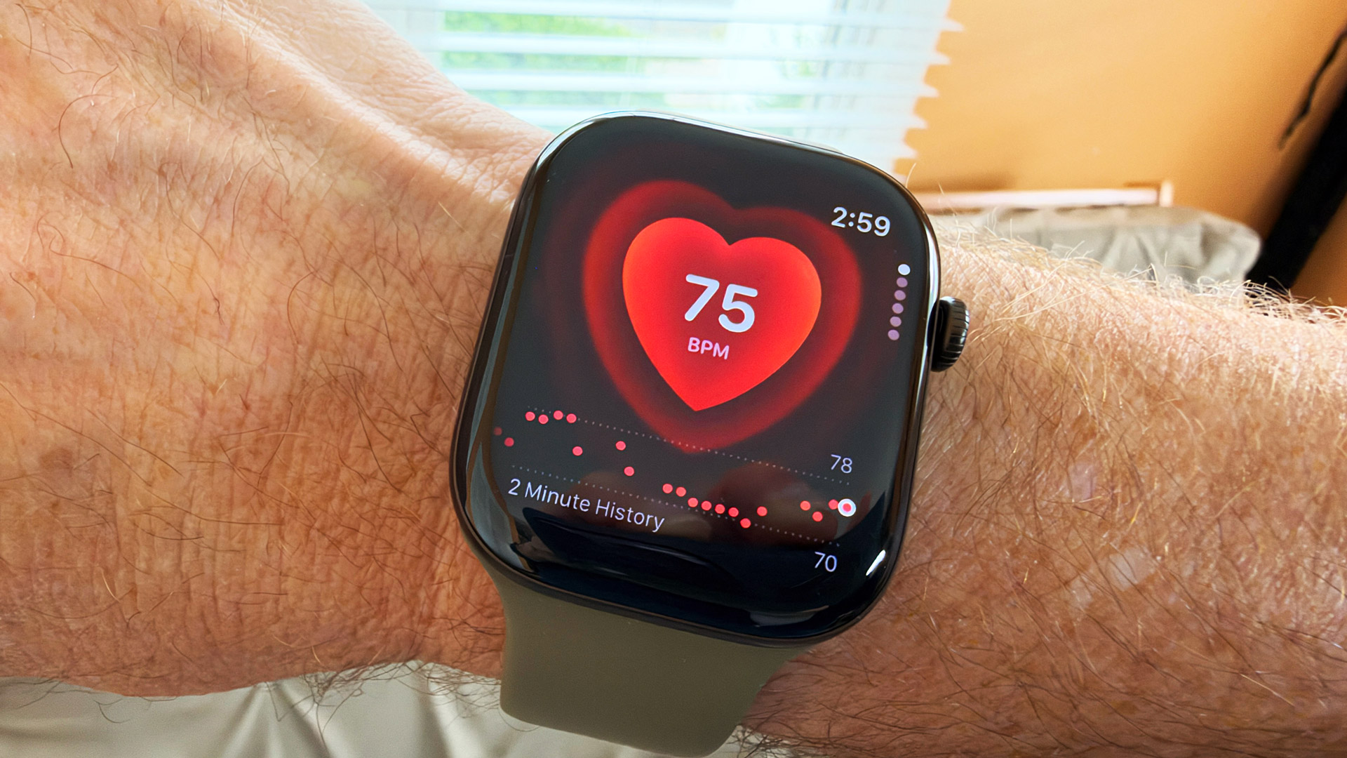 Apple Watch Series 12