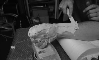 a plaster cast