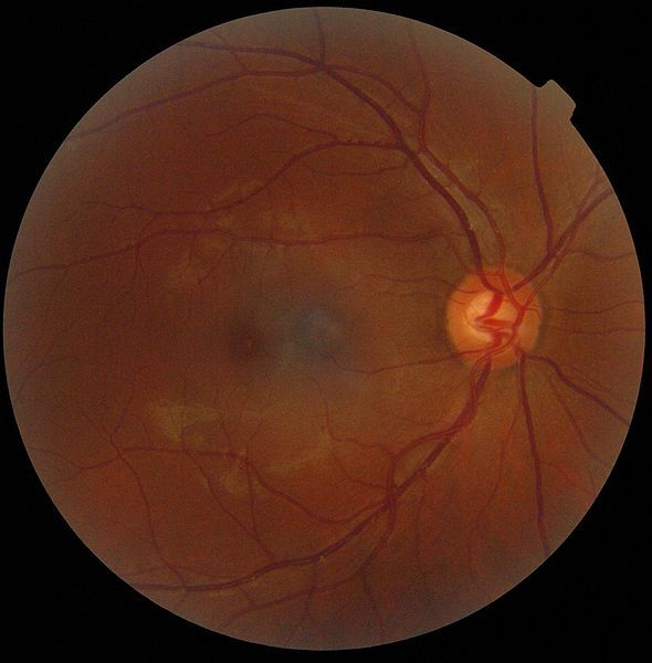 Ophtalmogram of a human eye. 