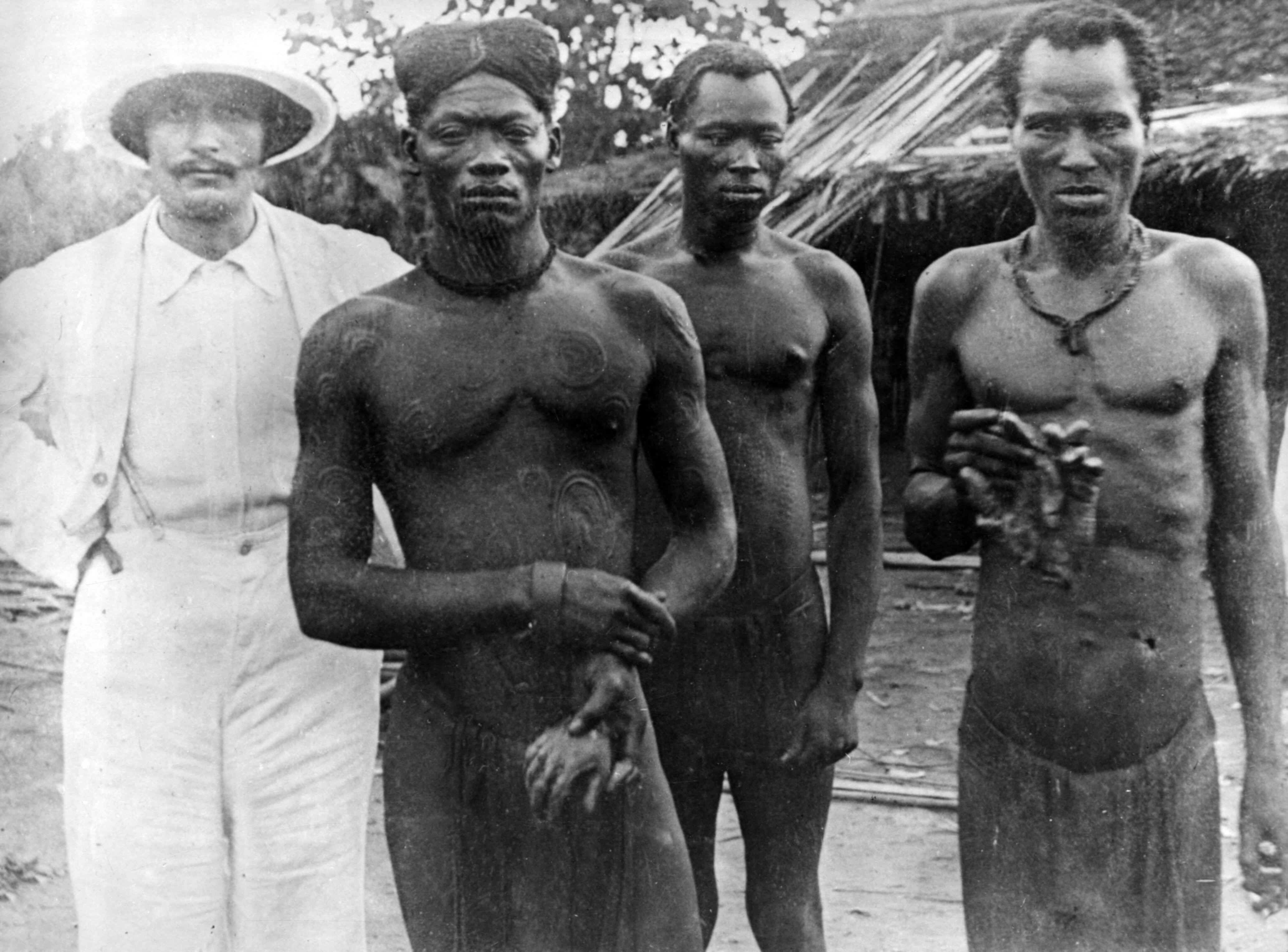 A missionary with Congolese men showing the amputated hands of two men (Lingomo and Bolenge) killed by free state troops employed as rubber sentries from the ABIR (Anglo-Belgian India Rubber company)Democratic Republic of Congo, Nsongo District Photo by Alice Seeley Harris and her husband John Harris taken in 1904 and used to support the Roger Casement case.