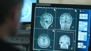 How To Change Your Mind episode 2 screengrab showing a doctor looking at several brain scans