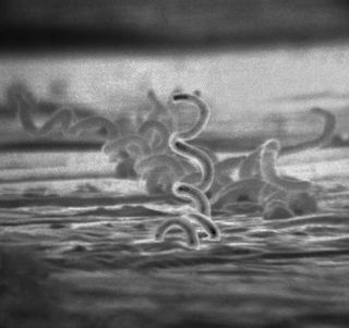 Syphilis is caused by Treponema pallidum, a spiral-shaped bacterium called a spirochete.