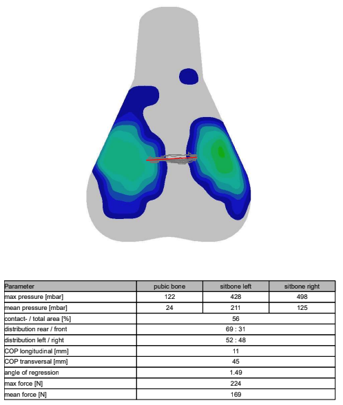 A visual output of saddle pressure mapping