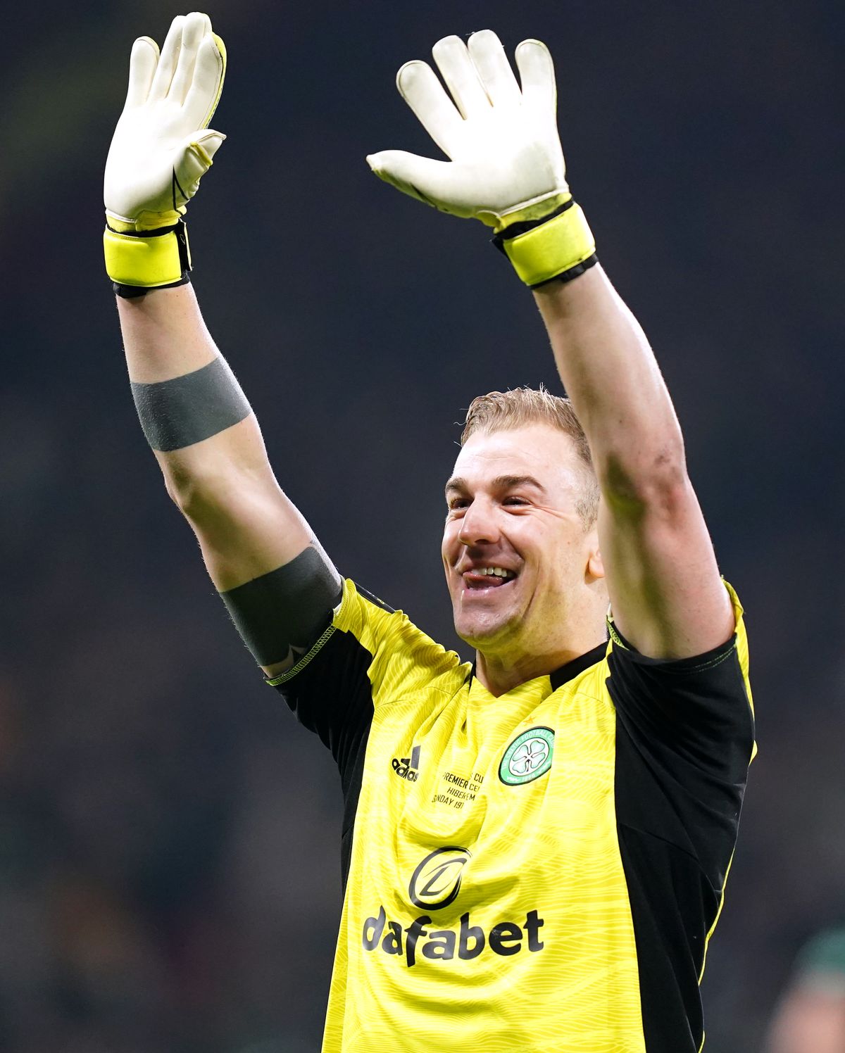 Hibernian v Celtic – Premier Sports Cup – Final – Hampden Park