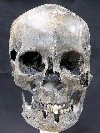 The 1,500-year-old skull (shown here after reconstruction) of a woman, who was part of an ancient royal dynasty called the Silla culture, shows she had an elongated head. 