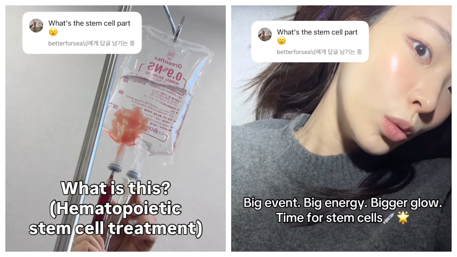 a split image of an IV with stem cells in the bag and a woman with glowing skin