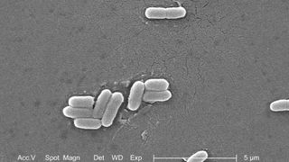 Escherichia coli bacteria.