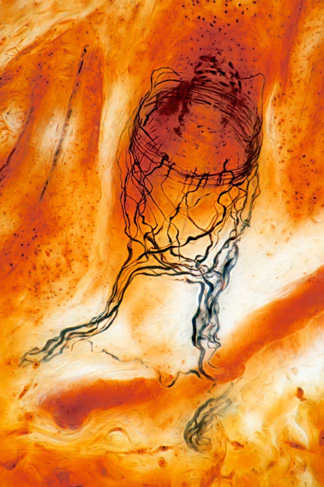 This image highlights the basket of nerve fibers at the end of a hair follicle. Sensory nerves allow us to detect stimuli such as movement, pressure and pain. This image received an award from the Wellcome Trust, as part of the annual Wellcome Image Award