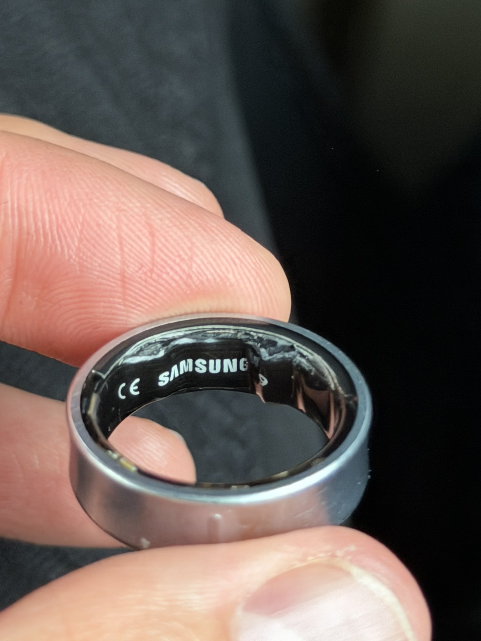 Swollen Samsung Galaxy Ring on the finger of Daniel Rotar