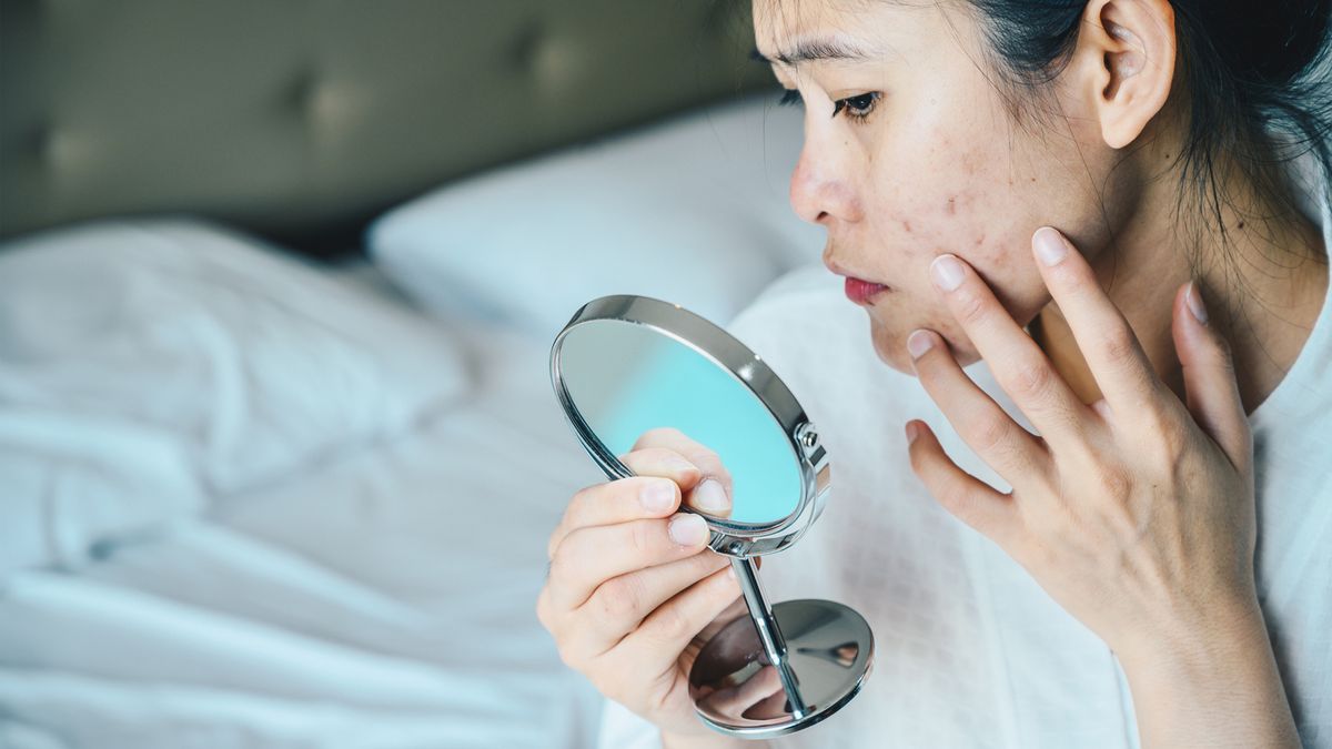 woman looking at her acne in the mirror